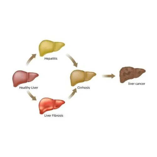 Norland Healthway Herbal Capsules - Treats Fatty Liver & Hepatitis - 30 Caps - Image 2